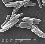 Mycobacterium tuberculosis. (c) CDC/ Dr. Ray Butler, Janice Carr via Wikimedia Commons