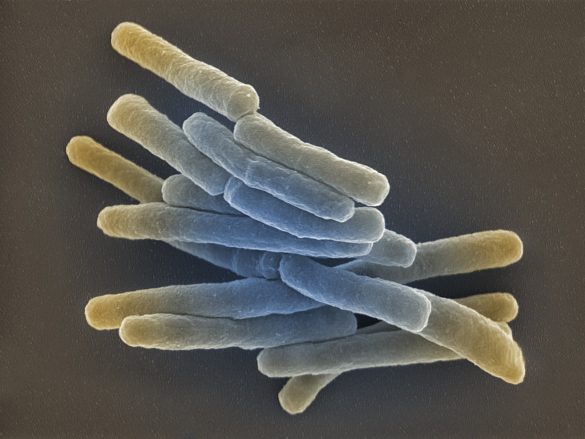 Tuberkulose 
˜ Bildnachweis: Gudrun Holland 2013/RKI