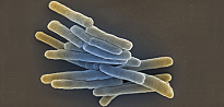 Mycobacterium tuberculosis. Scanning electron microscopy. Bar = 1 µm. Quelle: Gudrun Holland 2013/RKI